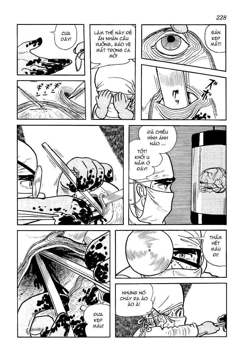 Black Jack Tập 160 trang 11
