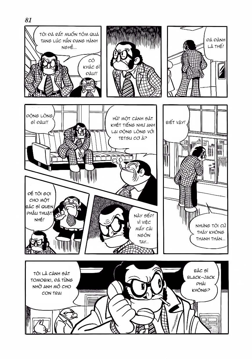 Black Jack Tập 174 trang 14