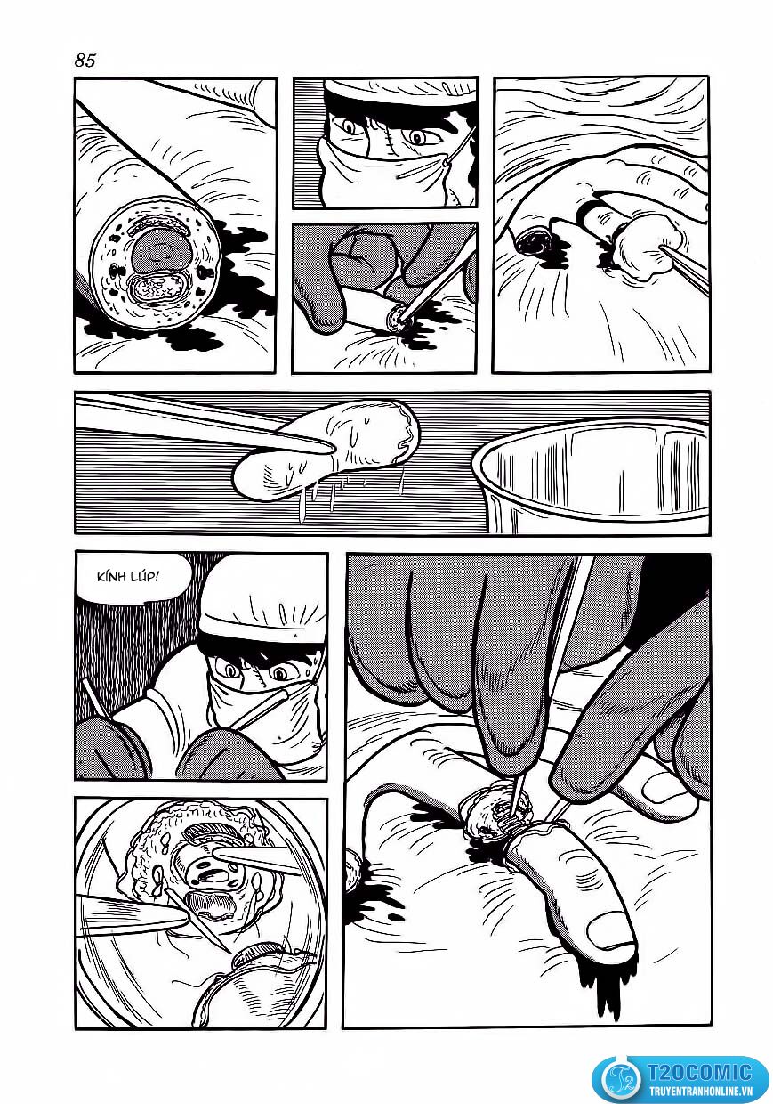Black Jack Tập 174 trang 18