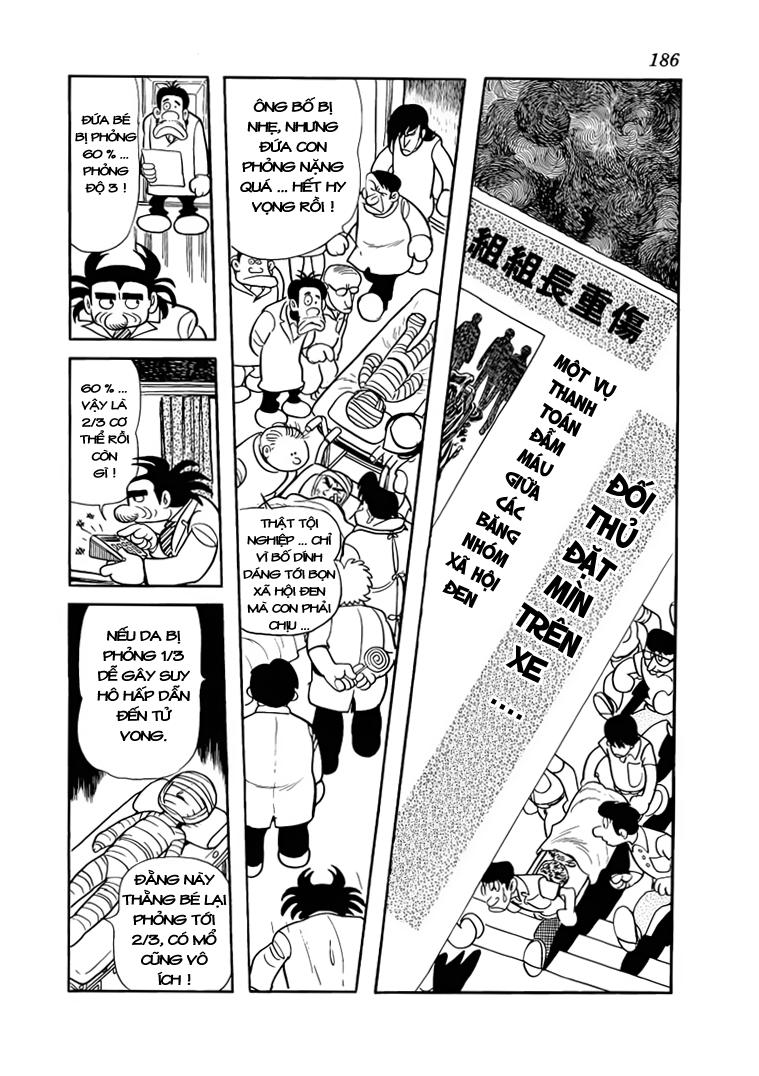 Black Jack Tập 18 trang 7