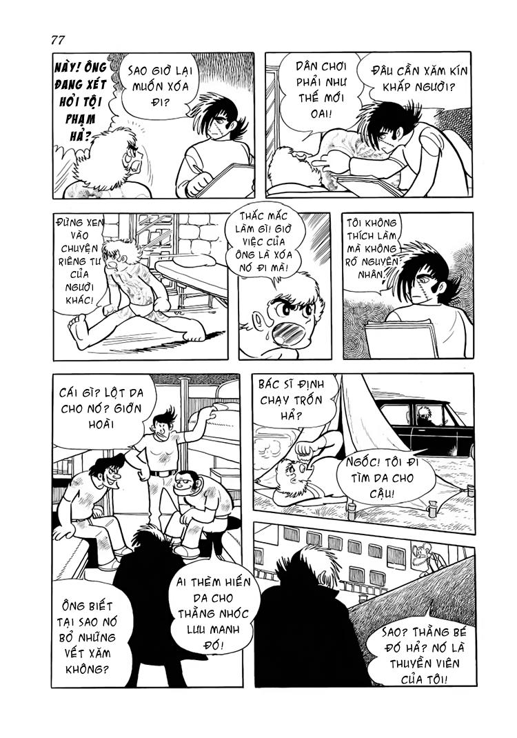 Black Jack Tập 33 trang 14