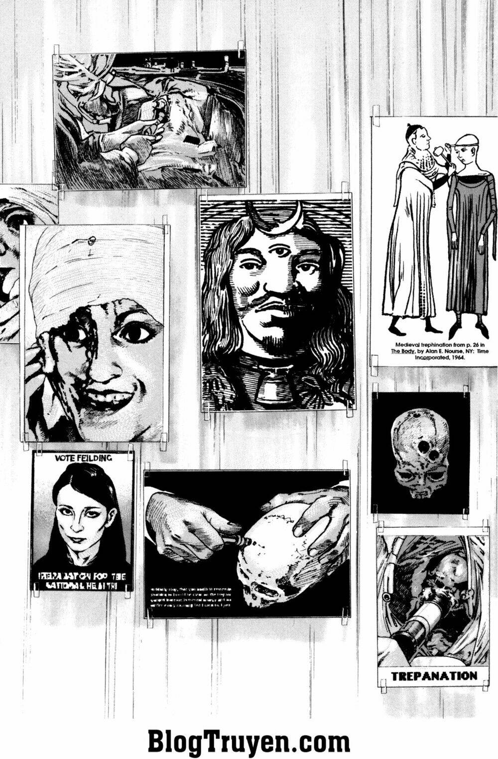 Homunculus Tập 104 trang 10