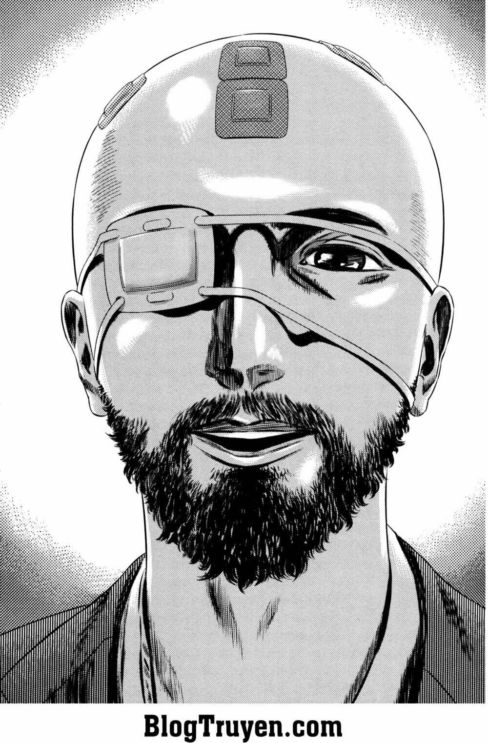 Homunculus Tập 158 trang 14
