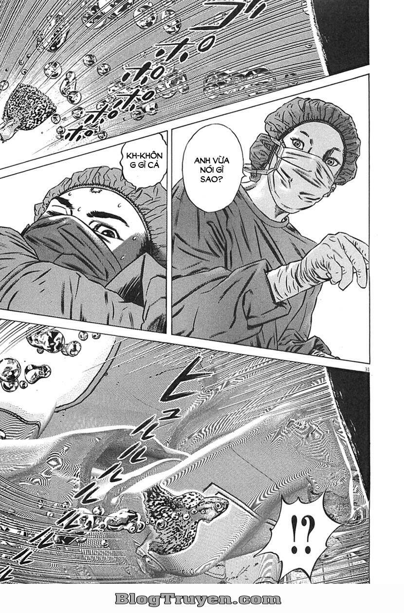 Homunculus Tập 63 trang 17