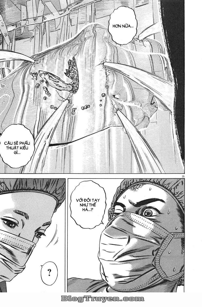 Homunculus Tập 63 trang 21