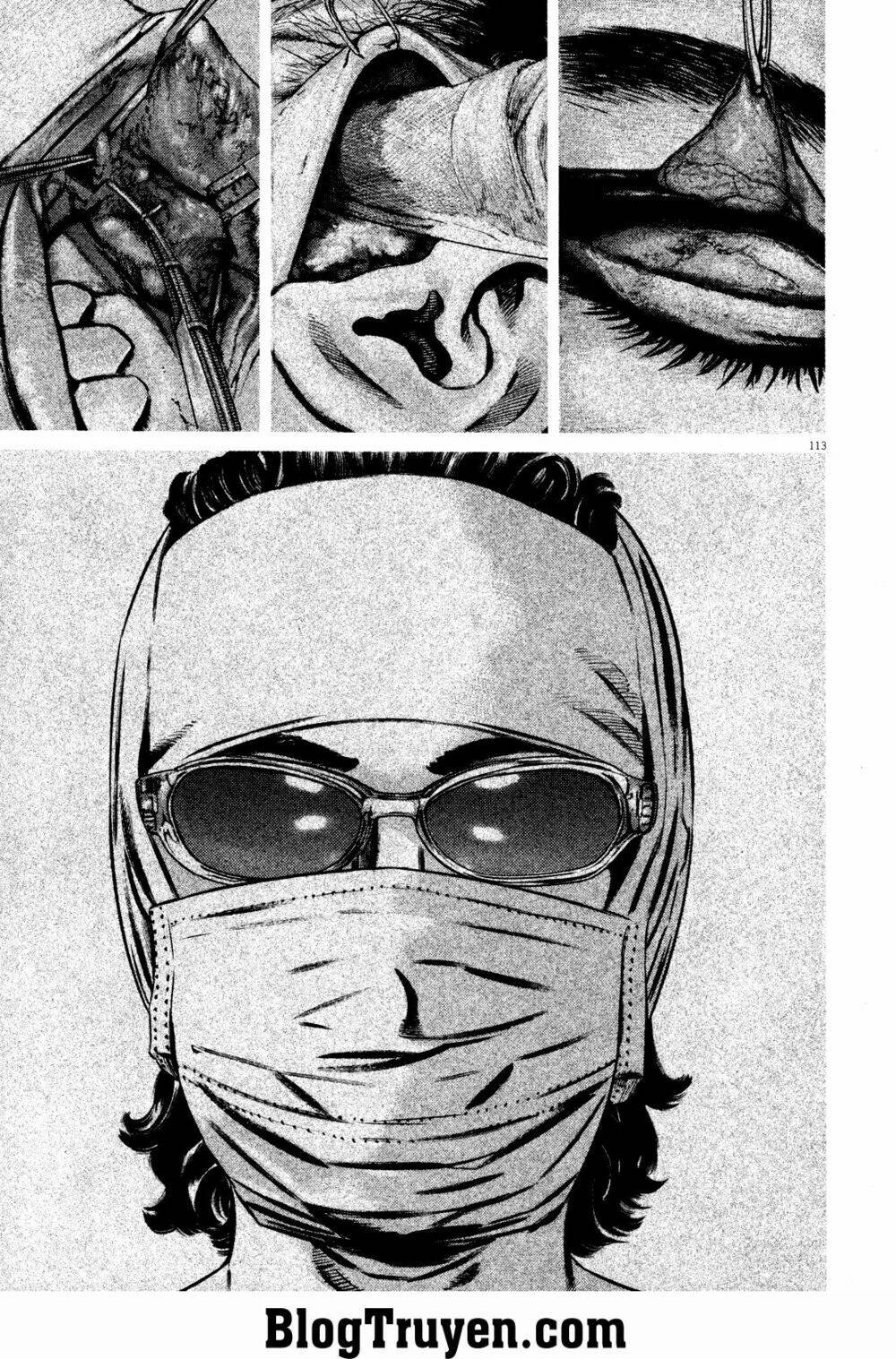 Homunculus Tập 76 trang 9